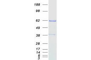 Validation with Western Blot