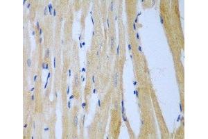 Immunohistochemistry of paraffin-embedded Rat heart using MGAT3 Polyclonal Antibody at dilution of 1:100 (40x lens). (MGAT3 anticorps)