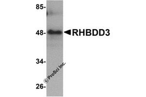 Western Blotting (WB) image for anti-Rhomboid Domain Containing 3 (RHBDD3) (Middle Region) antibody (ABIN1031062)