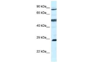 Western Blot showing AK7 antibody used at a concentration of 1 ug/ml against MCF7 Cell Lysate (Adenylate Kinase 7 anticorps  (C-Term))