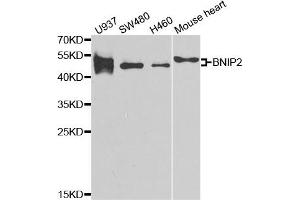 Western Blotting (WB) image for anti-BCL2/adenovirus E1B 19kDa Interacting Protein 2 (BNIP2) antibody (ABIN1980298) (BNIP2 anticorps)