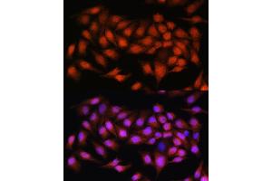 Immunofluorescence analysis of HeLa cells using BCL3 Rabbit pAb (ABIN6134239, ABIN6137509, ABIN6137510 and ABIN7101379) at dilution of 1:100.