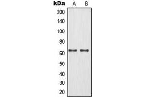 Western blot analysis of MNT expression in Jurkat (A), HeLa (B) whole cell lysates. (MNT anticorps  (Center))