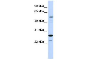 Western Blot showing PSMC3IP antibody used at a concentration of 1-2 ug/ml to detect its target protein. (PSMC3IP anticorps  (C-Term))