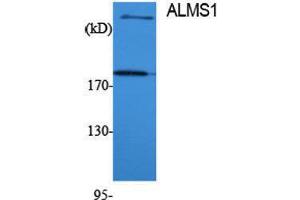 Western Blotting (WB) image for anti-Alstrom Syndrome 1 (ALMS1) (Internal Region) antibody (ABIN3173760) (ALMS1 anticorps  (Internal Region))