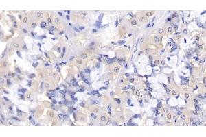 Detection of Bcl2L2 in Human Stomach Tissue using Polyclonal Antibody to B-Cell CLL/Lymphoma 2 Like Protein 2 (Bcl2L2)