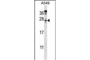 Western blot analysis in A549 cell line lysates (35ug/lane).
