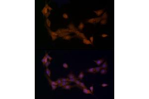 Immunofluorescence analysis of PC-12 cells using Ube2L3 / UBCH7 Rabbit mAb (ABIN7271178) at dilution of 1:25 (40x lens). (UBE2L3 anticorps)