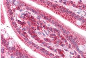 Human Small Intestine: Formalin-Fixed, Paraffin-Embedded (FFPE)