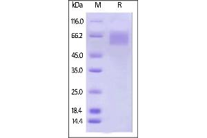 Biotinylated Human IL-17 RA, His,Avitag on  under reducing (R) condition.