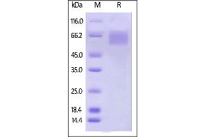 Biotinylated Human IL-17 RA, His,Avitag on  under reducing (R) condition. (IL17RA Protein (AA 33-320) (His tag,AVI tag,Biotin))