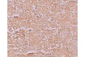 Immunohistochemical staining of mouse liver cells with SLC39A14 polyclonal antibody  at 2. (SLC39A14 anticorps  (Internal Region))