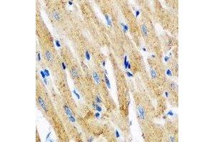 Immunohistochemical analysis of Tropomyosin 3 staining in mouse heart formalin fixed paraffin embedded tissue section. (TPM3 anticorps)
