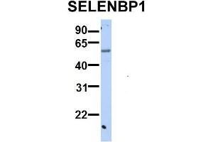 Host:  Rabbit  Target Name:  SERPINA3  Sample Type:  Human Adult Placenta  Antibody Dilution:  1.
