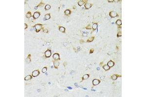 Immunohistochemistry of paraffin-embedded rat brain using PDPK1 antibody (ABIN3022351, ABIN3022352, ABIN3022353, ABIN1681308 and ABIN6218755) at dilution of 1:200 (40x lens).