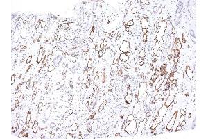 Formalin-fixed, paraffin-embedded human Kidney Transplant stained with Complement 4d Mouse Monoclonal Antibody (C4D204).