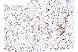 Formalin-fixed, paraffin-embedded human Kidney Transplant stained with Complement 4d Mouse Monoclonal Antibody (C4D204). (C4A anticorps)