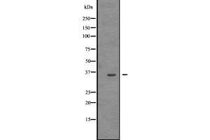 Western blot analysis of TRIO expression in HEK293 cells ,The lane on the left is treated with the antigen-specific peptide. (TRIO anticorps  (Internal Region))