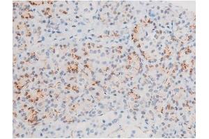 ABIN6267526 at 1/200 staining Human pancreas tissue sections by IHC-P.