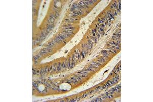 Immunohistochemistry (IHC) image for anti-Wingless-Type MMTV Integration Site Family, Member 10B (WNT10B) antibody (ABIN3002706)