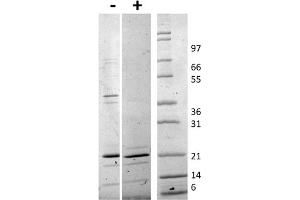 SDS-PAGE of Human TRAIL Recombinant Protein SDS-PAGE of Human TRAIL Recombinant Protein.
