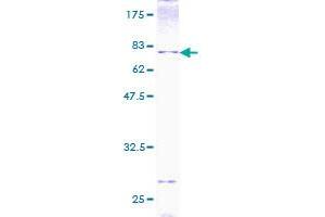 Image no. 1 for Bone Morphogenetic Protein 7 (BMP7) (AA 1-431) protein (GST tag) (ABIN1346771) (BMP7 Protein (AA 1-431) (GST tag))