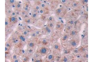 Detection of IL10Ra in Human Liver Tissue using Polyclonal Antibody to Interleukin 10 Receptor Alpha (IL10Ra) (IL-10RA anticorps  (AA 132-235))