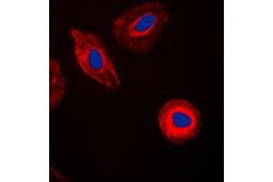 Immunofluorescent analysis of EIF4G2 staining in HeLa cells. (EIF4G2 anticorps  (N-Term))