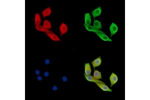 Estrogen-induced gene 121 protein Antibody staining Hela cells by IF/ICC.
