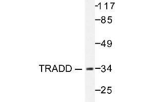 Image no. 1 for anti-TNFRSF1A-Associated Via Death Domain (TRADD) antibody (ABIN271966) (TRADD anticorps)