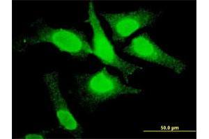 Immunofluorescence of monoclonal antibody to TOP3B on HeLa cell. (TOP3B anticorps  (AA 1-862))