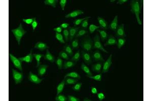 Immunofluorescence analysis of A549 cell using APEX1 antibody. (APEX1 anticorps)