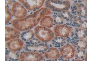 Detection of HJV in Human Kidney Tissue using Polyclonal Antibody to Hemojuvelin (HJV)