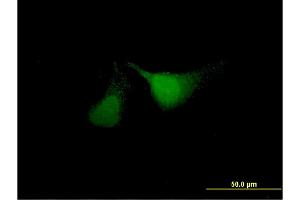 Immunofluorescence of monoclonal antibody to ANKRD37 on HeLa cell.
