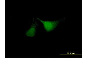 Immunofluorescence of monoclonal antibody to ANKRD37 on HeLa cell. (ANKRD37 anticorps  (AA 1-158))