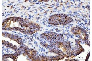 IHC analysis of ERP29 using anti-ERP29 antibody (ABIN7601342).