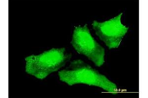 Immunofluorescence of monoclonal antibody to CTNNB1 on HeLa cell. (CTNNB1 anticorps  (AA 682-781))