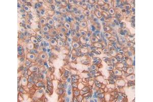 Used in DAB staining on fromalin fixed paraffin- embedded stomach tissue