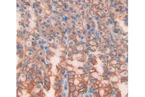 Used in DAB staining on fromalin fixed paraffin- embedded stomach tissue (OSTM1 anticorps  (AA 124-277))