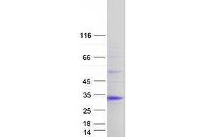 Validation with Western Blot