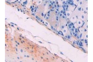 Detection of MYLK in Mouse Stomach Tissue using Polyclonal Antibody to Myosin Light Chain Kinase (MYLK) (MYLK anticorps  (AA 1684-1884))