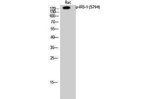 Western Blotting (WB) image for anti-Insulin Receptor Substrate 1 (IRS1) (pSer794) antibody (ABIN3182049)