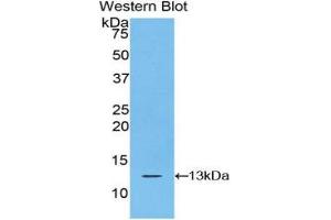 Western Blotting (WB) image for anti-S100 Calcium Binding Protein A10 (S100A10) (AA 1-97) antibody (ABIN1078493) (S100A10 anticorps  (AA 1-97))