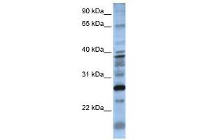 DOLPP1 antibody used at 1 ug/ml to detect target protein. (DOLPP1 anticorps  (N-Term))