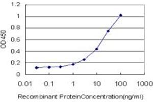 anti-Adenylate Cyclase 2 (Brain) (ADCY2) (AA 977-1086) antibody