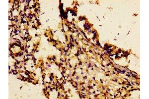 Immunohistochemistry of paraffin-embedded human lung tissue using ABIN7156829 at dilution of 1:100 (IL18R1 anticorps  (AA 22-128))