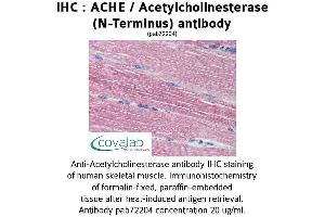 Image no. 1 for anti-Acetylcholinesterase (AChE) antibody (ABIN1731446) (Acetylcholinesterase anticorps)