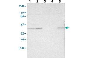 Western blot analysis of Lane 1: RT-4, Lane 2: U-251 MG, Lane 3: Human Plasma, Lane 4: Liver, Lane 5: Tonsil with MAFB polyclonal antibody  at 1:250-1:500 dilution. (MAFB anticorps)