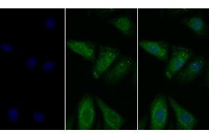 Detection of PDL1 in Human Hela cell using Polyclonal Antibody to Programmed Cell Death Protein 1 Ligand 1 (PDL1)