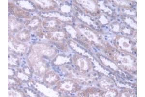 DAB staining on IHC-P; Samples: Human Kidney Tissue